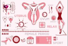 اضطرابات الدورة الشهرية أثناء الرضاعة