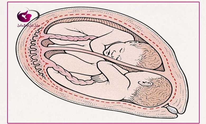 تعرفي على وضعية الجنين في الشهر التاسع دليل المرأة الحامل