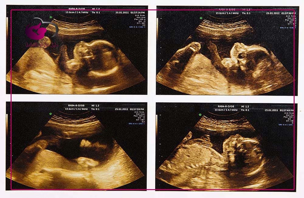 الحمل في الشهر الرابع بالصور
