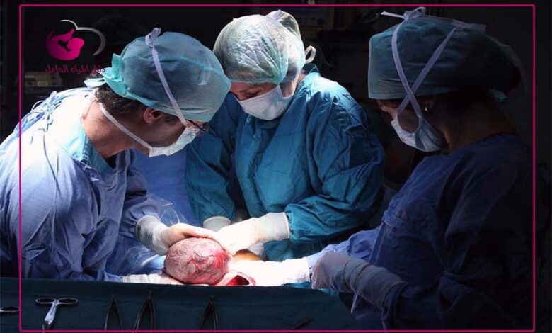 كم تستغرق العملية القيصرية وما هي تفاصيل الولادة القيصرية دليل المرأة الحامل