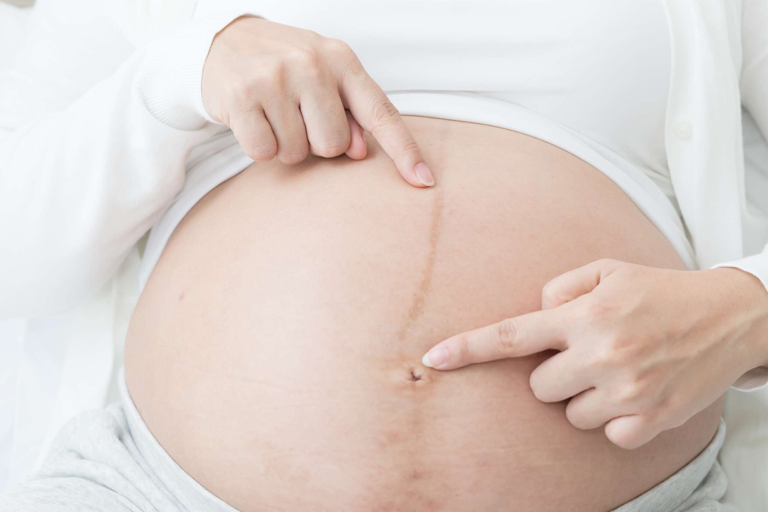 كيف اعرف نوع الجنين من شكل السره دليل المرأة الحامل