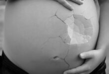 سواد الحلمتين أثناء الحمل: دليلكِ الشامل لفهم التغيرات الجلدية ونفي خرافات نوع الجنين